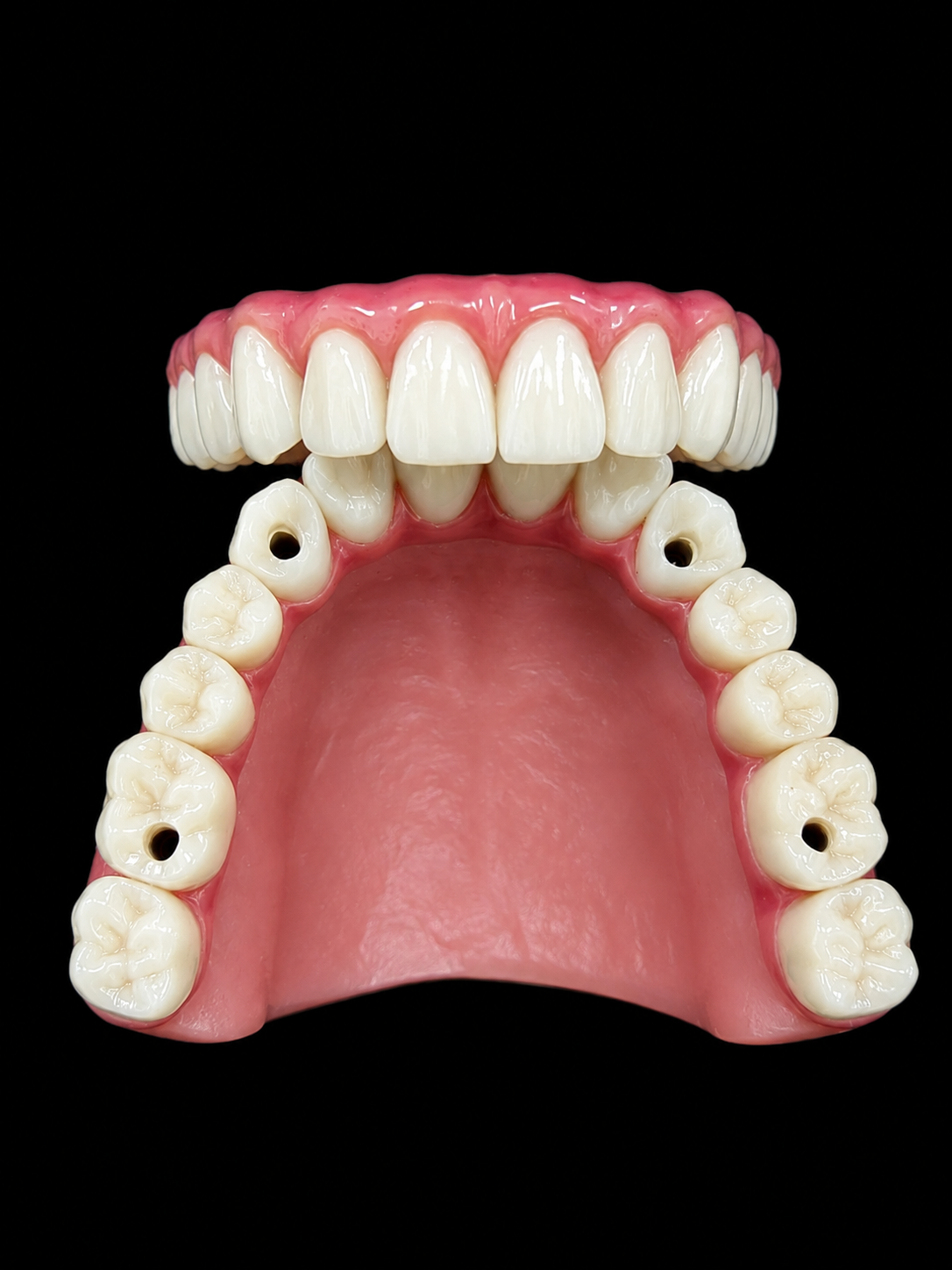 All-on-4 full zirconia bridge