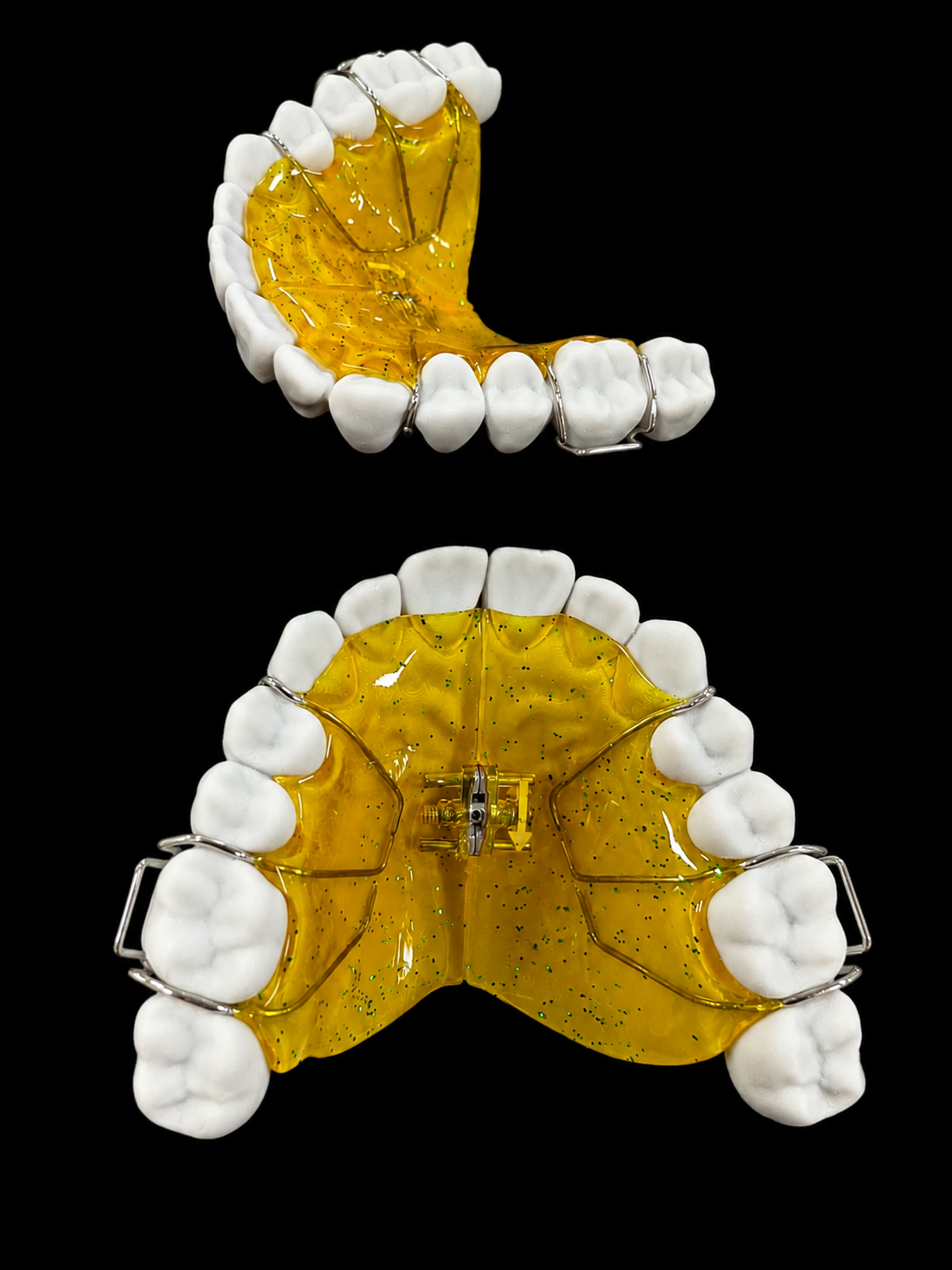 Palatal expander appliances
